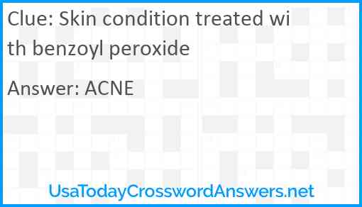 Skin condition treated with benzoyl peroxide Answer