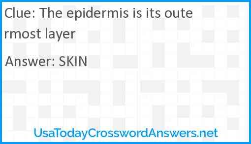 The epidermis is its outermost layer Answer